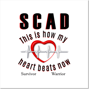 SCAD This Is How My Heart Beats Posters and Art